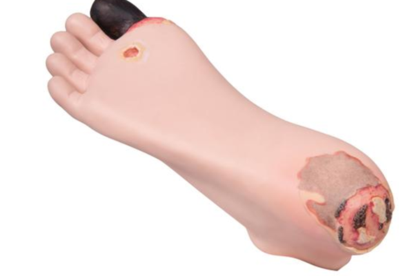 Simulateur traitement du pied décubitus
