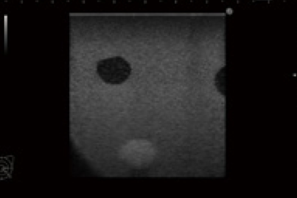 Simulateur de biopsie mammaire échoguidé – Image 4