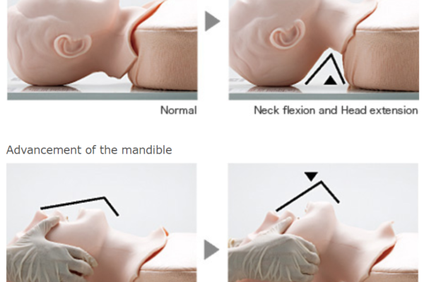 M167 - Airway Management Trainer – Image 6