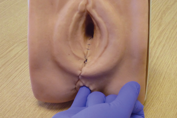 Simulateur en suture d'épisiotomie / réparation périnéale – Image 3